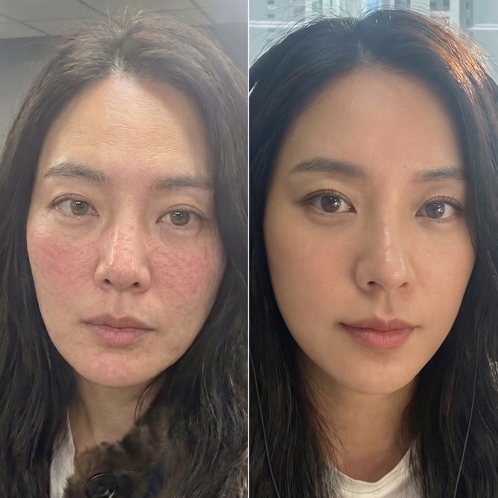 상품 썸네일 이미지
